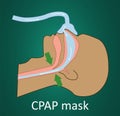 Vector illustration of breathing with CPAP mask.