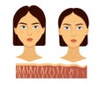 Vector illustration comparison of two female face young and aged skin fiber epidermis with collagen