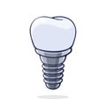 Vector illustration. Dental implant of human tooth. Fixture prothesis in dentistry. Symbol of somatology and oral hygiene