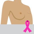 Breast cancer survivor. illustration with pink ribbon