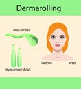 Vector illustration, derma mesorolling and before after effect