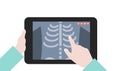 Vector illustration of a Doctor holding a tablet computer with a lung x-ray. Telemedicine, telemedicine flat illustration concept.