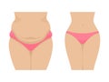 Vector illustration of a fat and thin female belly