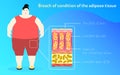 Obesity Medicine poster template in flat design