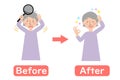 Before-after vector illustration of grandma suffering from dandruff of the scalp