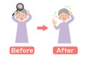 Before-after vector illustration of grandma suffering from thinning hair of the head