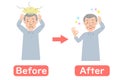 Before-after vector illustration of Grandpa suffering from dandruff of the scalp Royalty Free Stock Photo