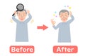 Before-after vector illustration of Grandpa suffering from dandruff of the scalp Royalty Free Stock Photo