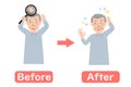 Before-after vector illustration of Grandpa suffering from thinning hair of the head