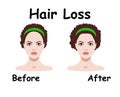 Vector illustration for hair loss treament