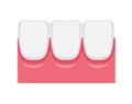 Vector illustration of healthy gums Royalty Free Stock Photo