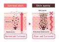 Illustration of how skin spots (hyperpigmentation) are created