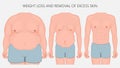 Human body problem_Weight loss and removal of excess skin front