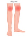 Bone fracture_Knee pain