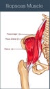 vector illustration of a iliopsoas muscle