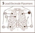 Vector illustration of a 5 lead electrode placement Royalty Free Stock Photo