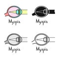 Vector illustration of myopia and eye symbol. Web element of myopia and cornea stock symbol for web.