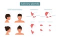Parotid, submandibular and sublingual salivary glands. The location of the salivary glands