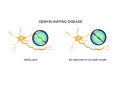 Process of nerve fiber destruction