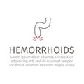 Vector illustration of a prolapsed hemorrhoid veins