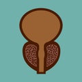 Vector illustration of prostatitis. sexual infections, prostate. Royalty Free Stock Photo