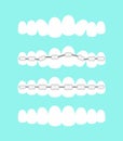 Vector illustration set of teeth, dental orthodontics treatment with teeth braces, process of level teeth, beautiful