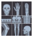 Vector illustration set of X-rays shots. Hand, Head, knee, and other parts of human body on X ray shots on white Royalty Free Stock Photo