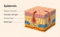 Illustration of human skin layers including epidermis and dermis Royalty Free Stock Photo