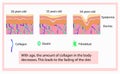 Vector illustration of structure cells with collagen, elastin and fibroblast, aging process