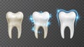 Vector illustration of teeth whitening process - cleaning and protection from stains and bacteria