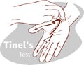 Vector illustration of a Tinel`s test