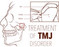 Vector illustration of treatment of tmj disorder