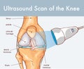 Vector illustration of a Ultrasound Scan of the Knee