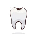 Vector illustration. Unhealthy human tooth with caries. Symbol of somatology and oral hygiene.