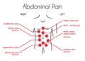 Vector Infographic of Abdominal Pain Types