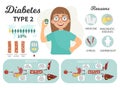 Vector infographic diabetes