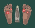 Vector isolated illustration of foot fungus.