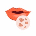 Vector isolated illustration of herpes on the lips.