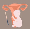 Vector isolated illustration of pregnancy. Trying to conceive. Health of a pregnant woman.