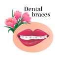 image of a smiling mouth with metal dental braces