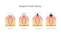 Vector isolated illustration of tooth