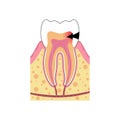 Vector isolated illustration of tooth