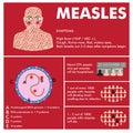 Vector measles infographic