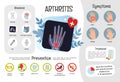 Vector medical poster arthritis. Royalty Free Stock Photo