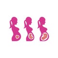 Vector of pregnant progress Royalty Free Stock Photo