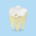 Vector realistic illustration of dirty unhealthy tooth with dental caries isolated. Dirty tooth