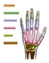 Hand bones with anotations for learning or medical publications. Royalty Free Stock Photo