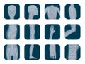 Vector realistic X-ray skeleton icons set. Human Skeleton xray elements. Body parts icon.