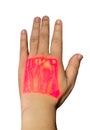 Vein finder handheld infrared of left hand showing cephalic vein and basilic vein .