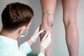 Vein markup. Vascular surgeon is marking veins for varicose surgery Royalty Free Stock Photo